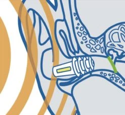 Sanohra - Vliegtuig - Kinderen - Oordoppen - 1 Paar 21 Sanohra - Vliegtuig - Kinderen - Oordoppen - 1 Paar -MEDISANA Shop 1200x1104 1