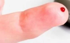 Beurer Glucosemeter GL44/50 Teststrips -MEDISANA Shop 1200x727 1