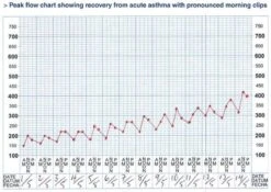Micropeak Peak Flow Meter -MEDISANA Shop 1200x850 1