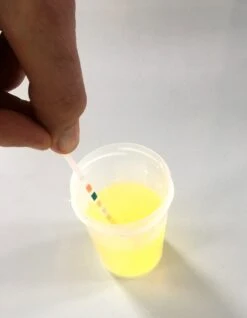 Urine ZelfTest Strips - 5 Stuks- Combur 7 - Met Duidelijk Testblad - Blaasontsteking- Lever/Nier- Ketose - Bloed - Urinetest - Brievenbus-levering 14 Urine ZelfTest Strips - 5 Stuks- Combur 7 - Met Duidelijk Testblad - Blaasontsteking- Lever/Nier- Ketose - Bloed - Urinetest - Brievenbus-levering -MEDISANA Shop 933x1200 1