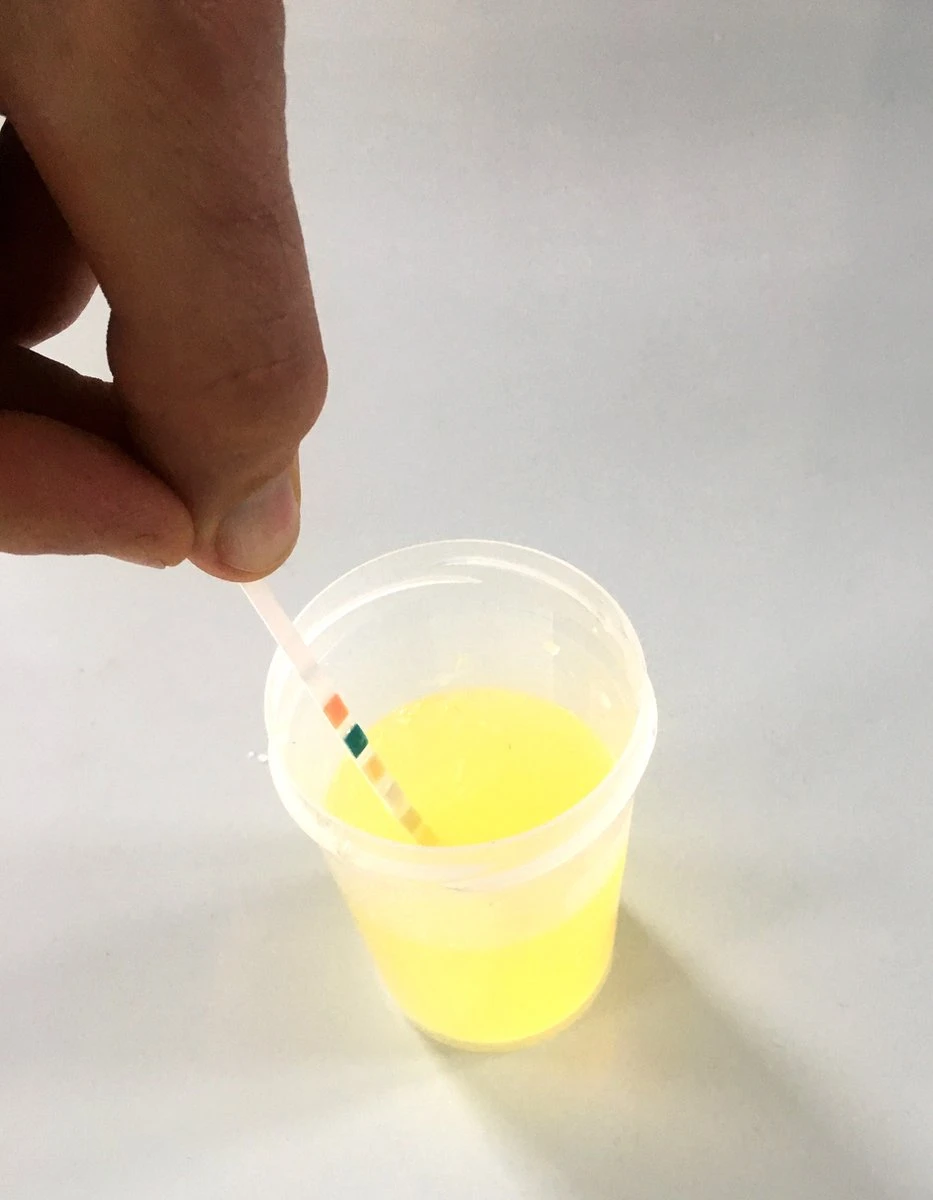 Urine ZelfTest Strips - 5 Stuks- Combur 7 - Met Duidelijk Testblad - Blaasontsteking- Lever/Nier- Ketose - Bloed - Urinetest - Brievenbus-levering 8 Urine ZelfTest Strips - 5 Stuks- Combur 7 - Met Duidelijk Testblad - Blaasontsteking- Lever/Nier- Ketose - Bloed - Urinetest - Brievenbus-levering - Afbeelding 6